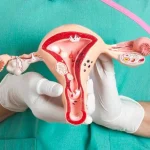 جراحی هیسترکتومی در تبریز