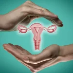 لاپاراسکوپی اندومتریوز