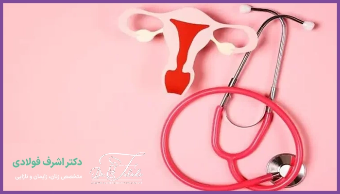تنبلی تخمدان چه علائمی را به همراه دارد؟