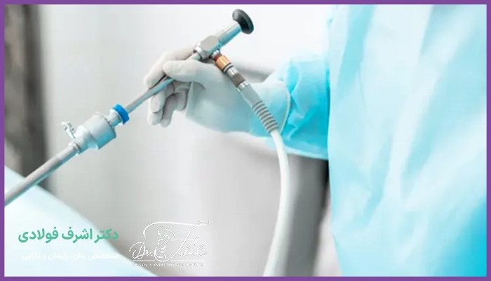 هزینه جراحی لاپاراسکوپی در تبریز چقدر است؟